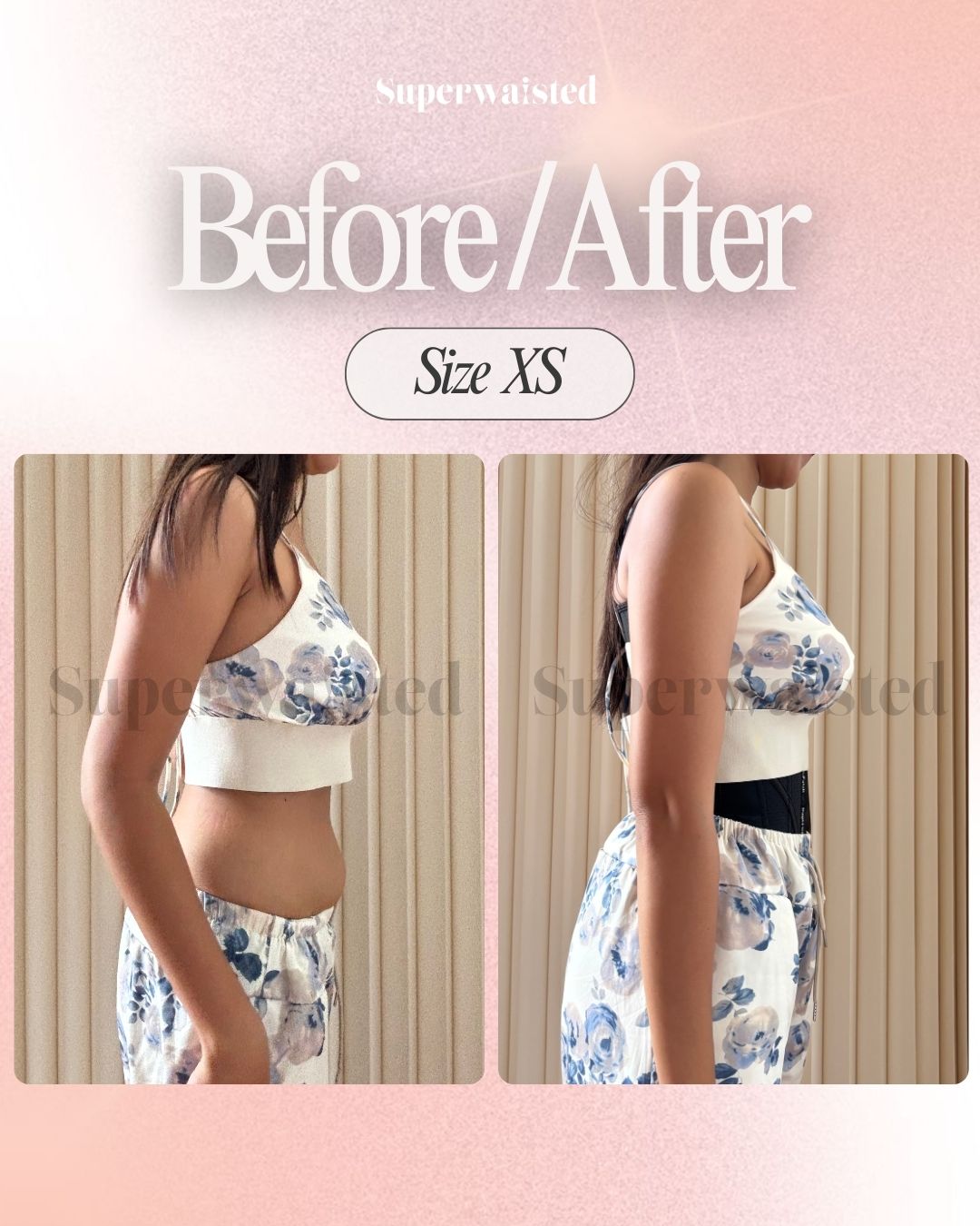 Before and After - Size XS